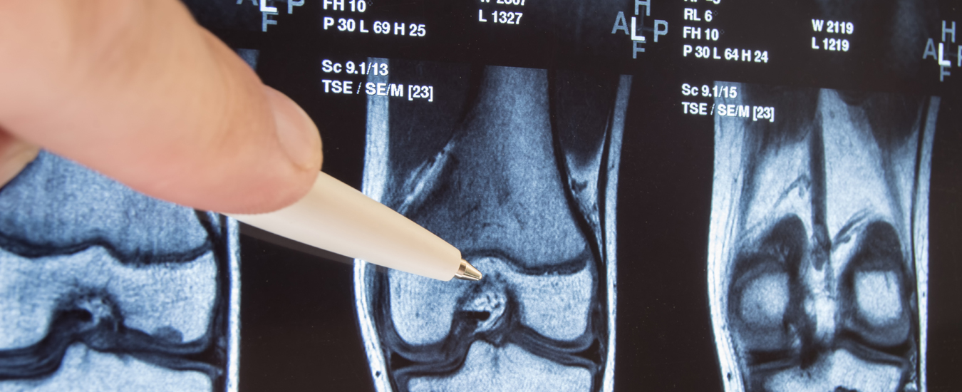 finger holding pen pointing to knee x-ray